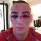 Image for article titled One Of The Most Brutal UFC Fights I've Seen In Ages